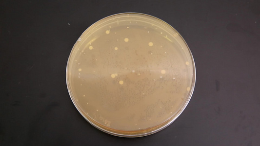 危险食品安全实验室检验菌落细菌培养皿视频