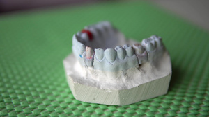 假牙模型9秒视频