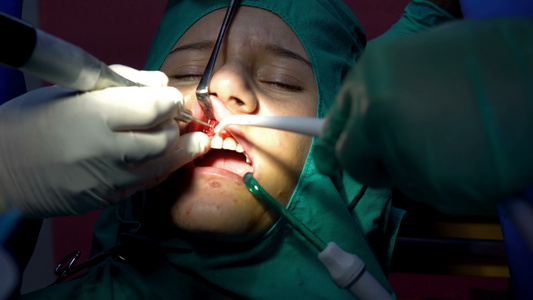 口腔外科手术脑电动切除术阴暗手术室视频