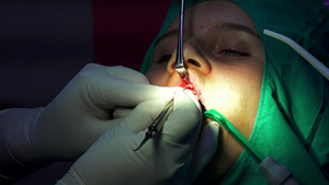 口腔外科手术脑电动切除术阴暗手术室30秒视频