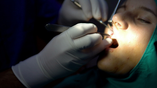 女性病人手术中的牙科外科医生皮眼切除手术视频