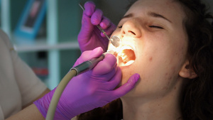用于龋齿保护的牙科涡轮钻蛀牙治疗牙医办公室治疗牙齿11秒视频