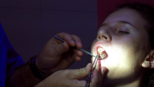 在内肠齿牙管填充申请期间在牙科女牙医上视频