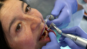 牙医治疗病人7秒视频