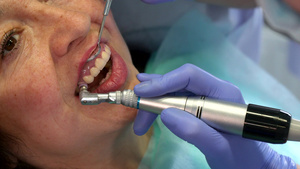 口腔牙医将预防杯移动到上开切器上方8秒视频