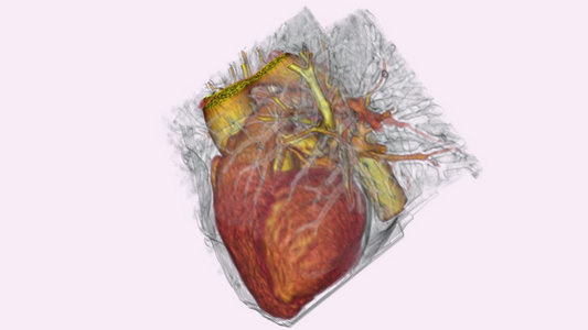 三维跳动人类的心脏视频
