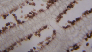 显微镜下的agaricus部分11秒视频
