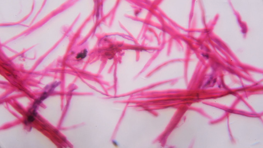 在显微镜下分离的光滑肌肉白色背景上的抽象粉色线条视频