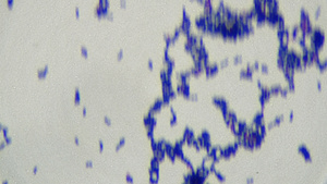 查看显微镜下的细菌13秒视频