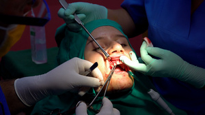在口腔细胞切除手术后缝针缝针外科18秒视频