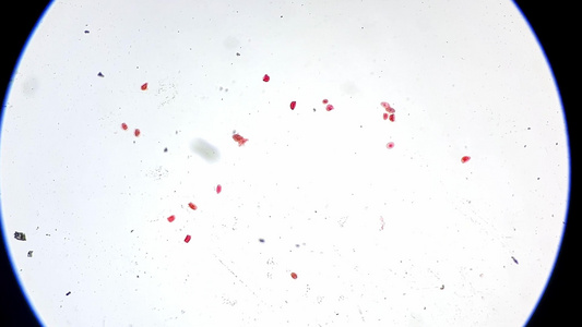 蛔虫卵装片显微镜观察视频