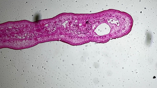寄生虫肝吸虫切片视频