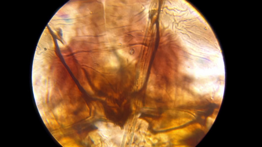 孑孓显微镜观察文字幼虫视频