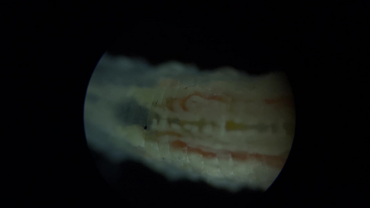 蠕虫微生物涡虫显微镜视频