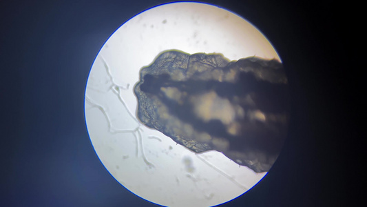 蠕虫微生物涡虫显微镜视频