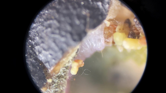 蠕虫蛀虫显微镜观察视频