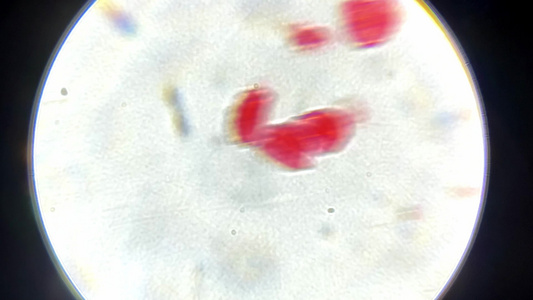 微生物显微镜观察绦虫卵视频
