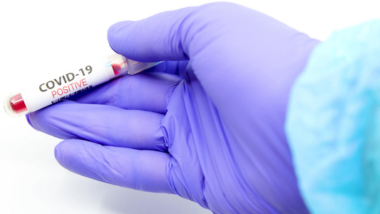 以蓝色外科手套对微生物学家或医务工作者的手进行缝合,标明血液检验结果,这对新的迅速传播的冠状腺病毒具有阳性。 视频