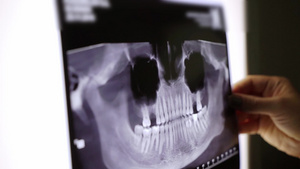 牙齿和下巴的X光胶片8秒视频