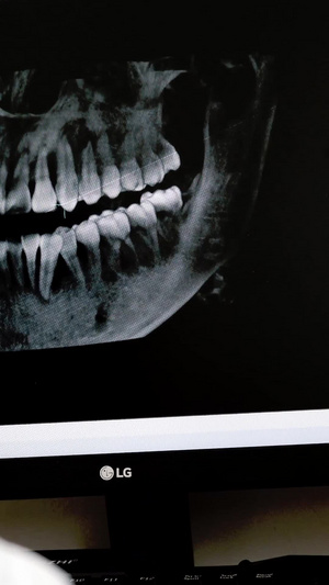 口腔科医生正在给病人看牙片医疗设备20秒视频