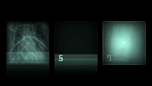 动画 - 黑色背景的X射线面板视频