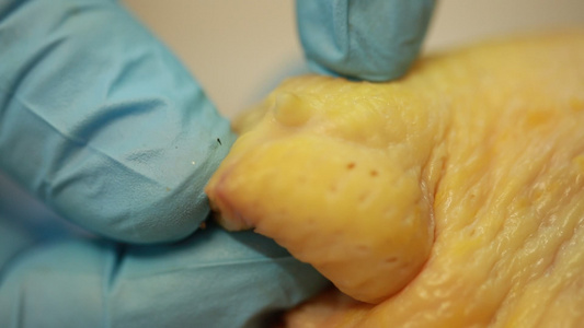 解剖肉鸡尾脂腺淋巴系统细菌 视频