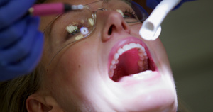 牙医检查病人的牙齿30秒视频