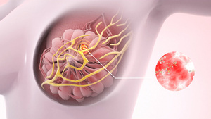 3d女性乳腺疾病动画15秒视频