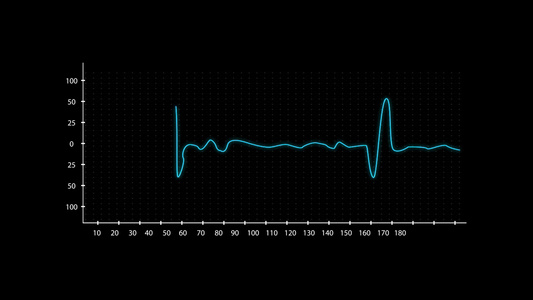 HUD元素-心电图（带通道）视频