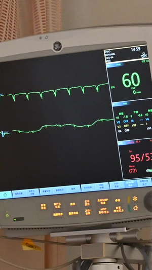 心脏监护器16秒视频