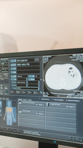 实拍电脑屏幕CT检查结果医疗设备视频