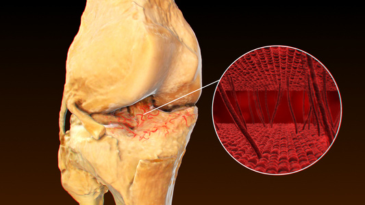 3D人体医疗骨关节炎视频