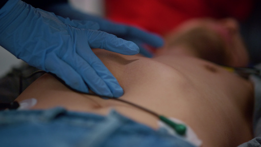 救护车医生双手在担架上为病人提供心血管按摩视频