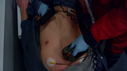 使用除颤器的辅助医务人员手生向男人提供急救帮助视频