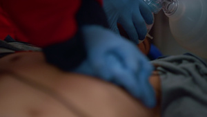 辅助医务人员的手为病胸部提供心脏按摩服务按摩制服16秒视频