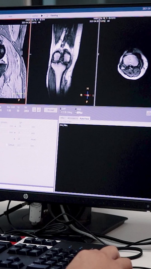 医生核磁共振检查素材14秒视频