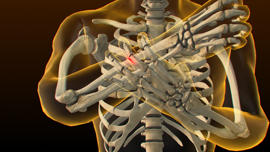 3D人体医疗骨裂视频