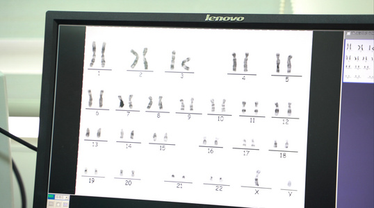 4K人类染色体检验视频