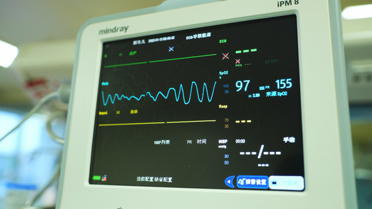 4K实拍医院ICU病房医疗仪器显示屏幕视频素材视频