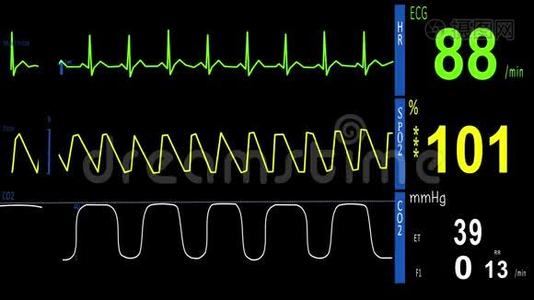 心电图，心脏监护仪视频