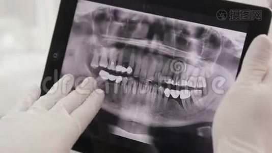 牙医显示病人X射线在平板上视频