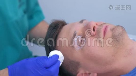 外科医生擦拭麻醉霜从人眼睑皮肤到乳头瘤激光去除。视频