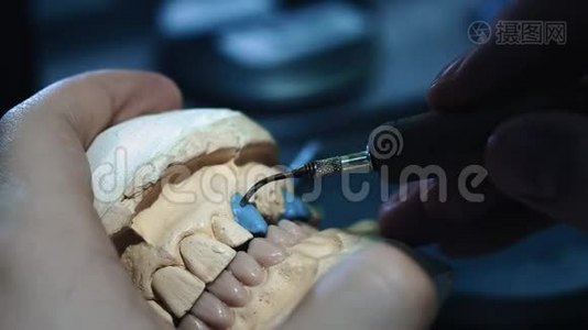 牙医医生在下巴上做假牙。 牙科医生手里拿着一个下巴植入物，用这种材料视频