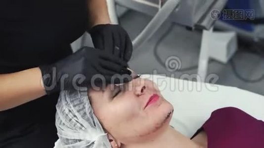 激光剥离后，美容师用湿棉布从黑色面罩上清洁女性皮肤视频