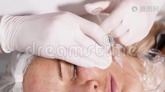 医生美容师病人`脸视频