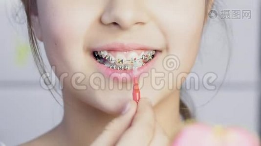 少女用透明金属牙套清洁牙齿视频
