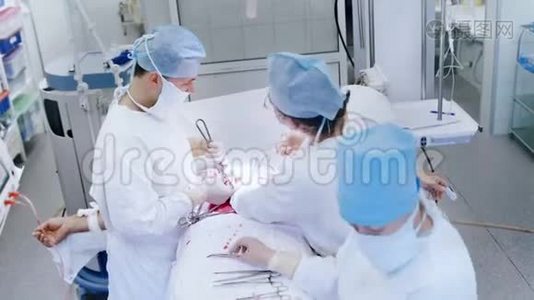 手术室进行腹腔手术的专业外科医生俯视图组视频