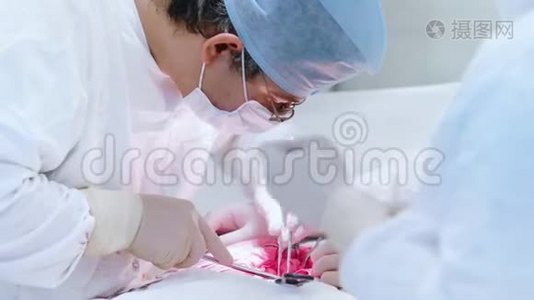 繁忙的专业外科医生做腹腔手术视频