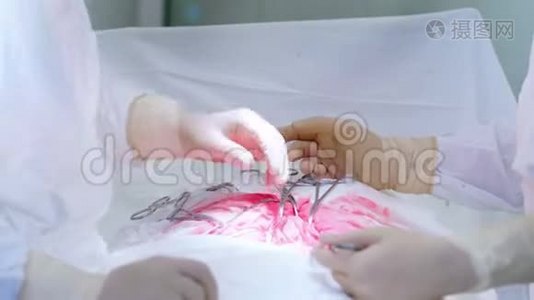 专业医护人员进行腹腔手术的特写视频