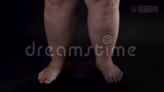 肥胖的男性腿部转向黑暗背景，身体护理，不健康的营养视频